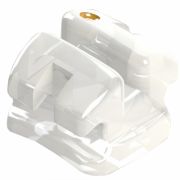 Br&aacute;quete Roth Cer&acirc;micos &ndash; Dental Morelli